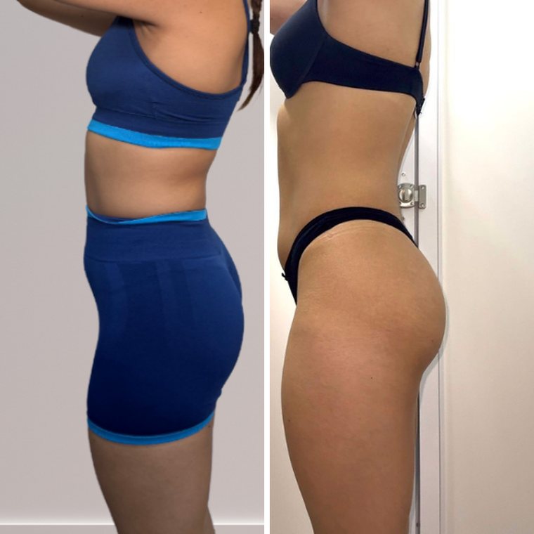 Antes y después de Camila, clienta de GlowFit, vista de perfil