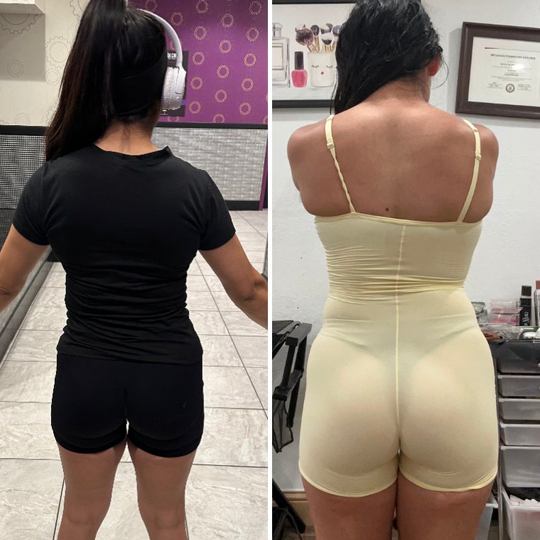 Antes y después de Monse, clienta de GlowFit, vista de espalda