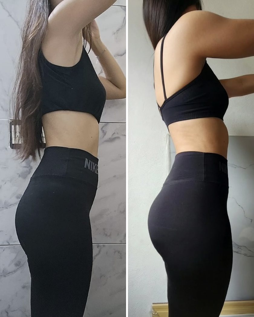 Antes y después de Magali, clienta de GlowFit, vista de perfil